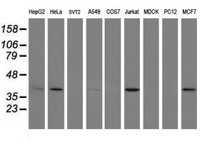 ERCC1 Antibody - Western blot of extracts (35ug) from 9 different cell lines by using anti-ERCC1 monoclonal antibody.