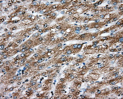 ERCC1 Antibody - Immunohistochemical staining of paraffin-embedded liver tissue using anti-ERCC1 mouse monoclonal antibody. (Dilution 1:50).