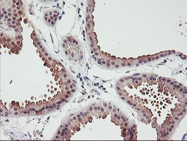 ERCC1 Antibody - IHC of paraffin-embedded Human breast tissue using anti-ERCC1 mouse monoclonal antibody.