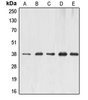 ERCC1 Antibody - Western blot analysis of ERCC1 expression in MCF7 (A); HeLa (B); A431 (C); mouse liver (D); rat kidney (E) whole cell lysates.