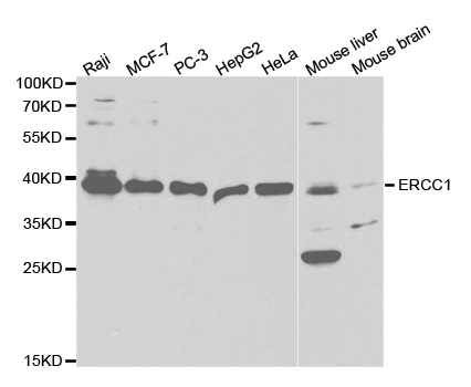 ERCC1 Antibody - Western blot analysis of extracts of various cell lines, using ERCC1 antibody.