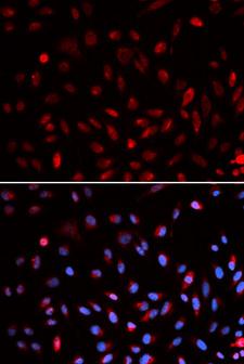 ERCC1 Antibody - Immunofluorescence analysis of U2OS cell using ERCC1 antibody. Blue: DAPI for nuclear staining.