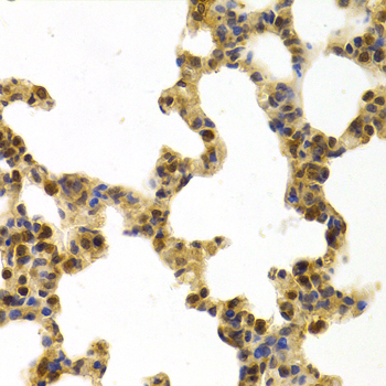 ERCC1 Antibody - Immunohistochemistry of paraffin-embedded rat lung tissue.