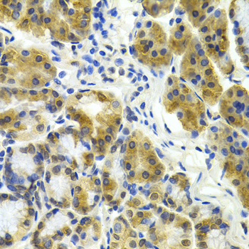 ERCC1 Antibody - Immunohistochemistry of paraffin-embedded human rectum tissue.