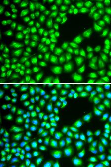 ERCC1 Antibody - Immunofluorescence analysis of A549 cells.