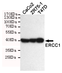 ERCC1 Antibody - Western blot detection of ERCC1 in T47D, ZR75-1, CaCO2 and Molt-4 cell lysate using ERCC1 mouse monoclonal antibody (1:1000 dilution). Predicted band size: 39KDa. Observed band size: 39KDa.