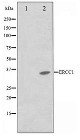 ERCC1 Antibody - Western blot of NIH-3T3 cell lysate using ERCC1 Antibody