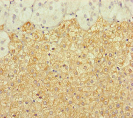 ERCC1 Antibody - Immunohistochemistry of paraffin-embedded human adrenal gland tissue at dilution of 1:100