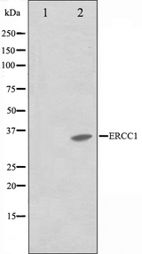 ERCC1 Antibody - Western blot analysis on NIH-3T3 cell lysates using ERCC1 antibody. The lane on the left is treated with the antigen-specific peptide.