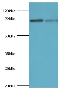 ERCC2 / XPD Antibody - Western blot. All lanes: TFIIH basal transcription factor complex helicase XPD subunit antibody at 2 ug/ml. Lane 1: 293T whole cell lysate. Lane 2: K562 whole cell lysate. secondary Goat polyclonal to rabbit at 1:10000 dilution. Predicted band size: 87 kDa. Observed band size: 87 kDa.