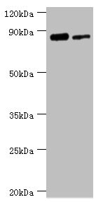 ERCC2 / XPD Antibody - Western blot All lanes: TFIIH basal transcription factor complex helicase XPD subunit antibody at 2µg/ml Lane 1: 293T whole cell lysate Lane 2: K562 whole cell lysate Secondary Goat polyclonal to rabbit IgG at 1/10000 dilution Predicted band size: 87, 47 kDa Observed band size: 87 kDa