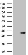 ERCC2 / XPD Antibody - Human recombinant protein fragment corresponding to amino acids 78-307 of human ERCC2. (NP_000391) produced in E.coli.