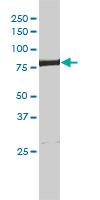 ERCC2 / XPD Antibody - ERCC2 monoclonal antibody (M01), clone 4G2-2A6 Western Blot analysis of ERCC2 expression in HeLa NE.