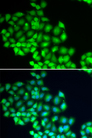 ERCC2 / XPD Antibody - Immunofluorescence analysis of HeLa cells.