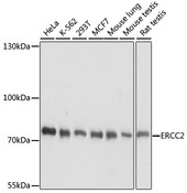 ERCC2 / XPD Antibody - Western blot analysis of extracts of various cell lines, using ERCC2 antibody at 1:1000 dilution. The secondary antibody used was an HRP Goat Anti-Rabbit IgG (H+L) at 1:10000 dilution. Lysates were loaded 25ug per lane and 3% nonfat dry milk in TBST was used for blocking. An ECL Kit was used for detection and the exposure time was 10s.
