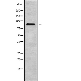 ERCC2 / XPD Antibody - Western blot analysis of ERCC2 using A549 whole cells lysates