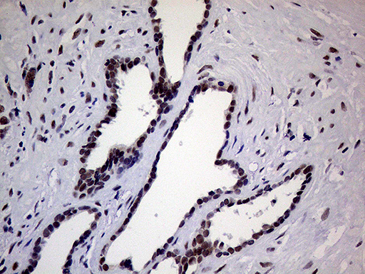 ERCC3 / XPB Antibody - Immunohistochemical staining of paraffin-embedded Human prostate tissue within the normal limits using anti-ERCC3 mouse monoclonal antibody. (Heat-induced epitope retrieval by 1mM EDTA in 10mM Tris buffer. (pH8.5) at 120°C for 3 min. (1:1000)