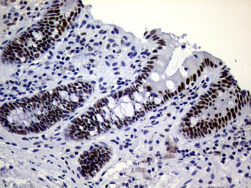 ERCC3 / XPB Antibody - Immunohistochemical staining of paraffin-embedded Human colon tissue within the normal limits using anti-ERCC3 mouse monoclonal antibody. (Heat-induced epitope retrieval by 1mM EDTA in 10mM Tris buffer. (pH8.5) at 120°C for 3 min. (1:1000)
