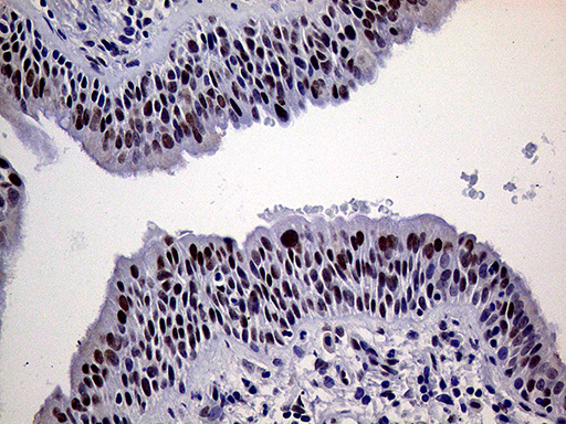 ERCC3 / XPB Antibody - Immunohistochemical staining of paraffin-embedded Human lung tissue within the normal limits using anti-ERCC3 mouse monoclonal antibody. (Heat-induced epitope retrieval by 1mM EDTA in 10mM Tris buffer. (pH8.5) at 120°C for 3 min. (1:1000)