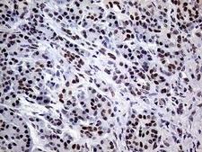ERCC3 / XPB Antibody - Immunohistochemical staining of paraffin-embedded Human pancreas tissue within the normal limits using anti-ERCC3 mouse monoclonal antibody. (Heat-induced epitope retrieval by 1mM EDTA in 10mM Tris buffer. (pH8.5) at 120°C for 3 min. (1:1000)