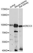 ERCC3 / XPB Antibody - Western blot analysis of extracts of various cell lines, using ERCC3 antibody at 1:3000 dilution. The secondary antibody used was an HRP Goat Anti-Rabbit IgG (H+L) at 1:10000 dilution. Lysates were loaded 25ug per lane and 3% nonfat dry milk in TBST was used for blocking. An ECL Kit was used for detection and the exposure time was 90s.