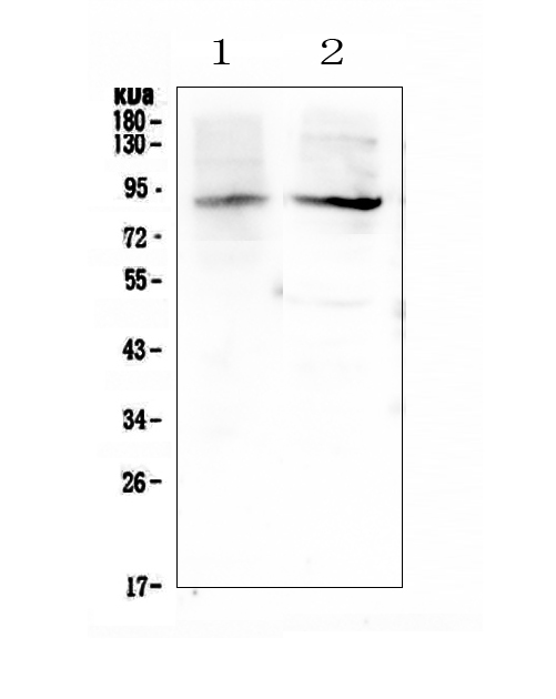 ERCC3 / XPB Antibody - Western blot analysis of XPB using anti-XPB antibody. Electrophoresis was performed on a 5-20% SDS-PAGE gel at 70V (Stacking gel) / 90V (Resolving gel) for 2-3 hours. The sample well of each lane was loaded with 50ug of sample under reducing conditions. Lane 1: rat testis tissue lysates,Lane 2: mouse testis tissue lysates. After Electrophoresis, proteins were transferred to a Nitrocellulose membrane at 150mA for 50-90 minutes. Blocked the membrane with 5% Non-fat Milk/ TBS for 1.5 hour at RT. The membrane was incubated with rabbit anti-XPB antigen affinity purified polyclonal antibody at 0.5 µg/mL overnight at 4°C, then washed with TBS-0.1% Tween 3 times with 5 minutes each and probed with a goat anti-rabbit IgG-HRP secondary antibody at a dilution of 1:10000 for 1.5 hour at RT. The signal is developed using an Enhanced Chemiluminescent detection (ECL) kit with Tanon 5200 system. A specific band was detected for XPB at approximately 89KD. The expected band size for XPB is at 89KD.