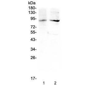 ERCC3 / XPB Antibody - Western blot testing of 1) rat testis and 2) mouse testis lysate with XPB antibody at 0.5ug/ml. Predicted molecular weight ~89 kDa.