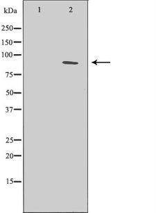 ERCC3 / XPB Antibody - Western blot analysis of extracts of COLO 320 using ERCC3 antibody. The lane on the left is treated with the antigen-specific peptide.