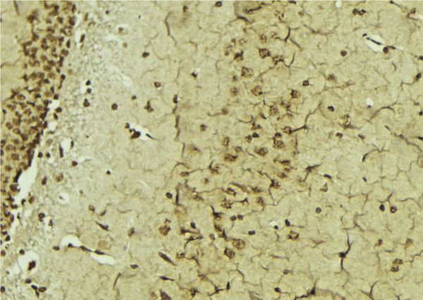 ERCC3 / XPB Antibody - 1:100 staining mouse brain tissue by IHC-P. The sample was formaldehyde fixed and a heat mediated antigen retrieval step in citrate buffer was performed. The sample was then blocked and incubated with the antibody for 1.5 hours at 22°C. An HRP conjugated goat anti-rabbit antibody was used as the secondary.