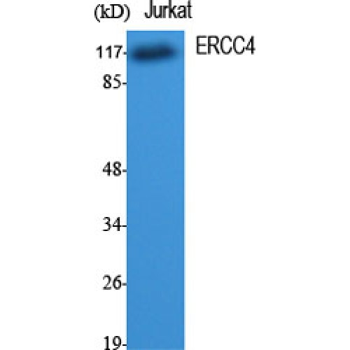ERCC4 / XPF Antibody - Western blot of ERCC4 antibody