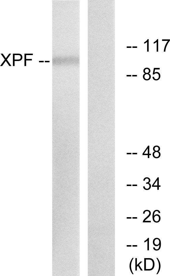 ERCC4 / XPF Antibody - Western blot analysis of lysates from 293 cells, using XPF Antibody. The lane on the right is blocked with the synthesized peptide.