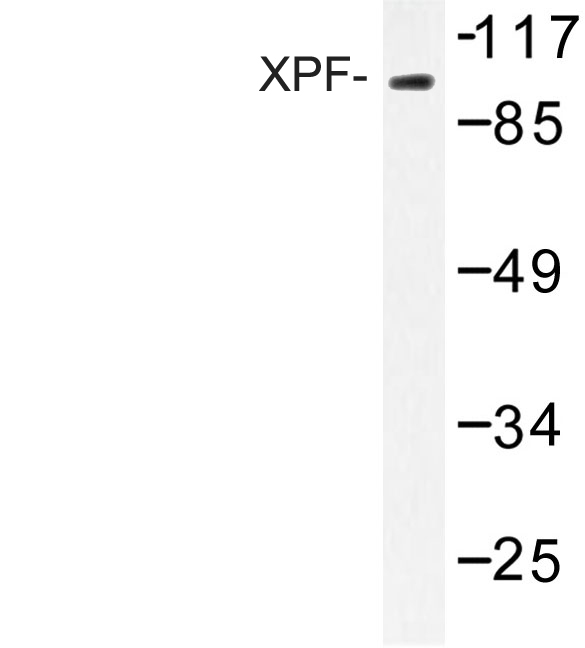 ERCC4 / XPF Antibody - Western blot of XPF (A822) pAb in extracts from 293 cells.