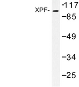 ERCC4 / XPF Antibody - Western blot of XPF (A822) pAb in extracts from 293 cells.