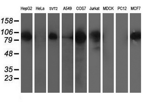 ERCC4 / XPF Antibody - Western blot of extracts (35 ug) from 9 different cell lines by using anti-ERCC4 monoclonal antibody.