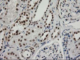 ERCC4 / XPF Antibody - IHC of paraffin-embedded Human Kidney tissue using anti-ERCC4 mouse monoclonal antibody.