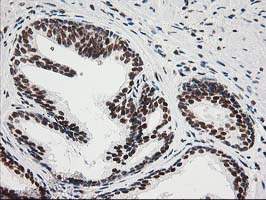 ERCC4 / XPF Antibody - IHC of paraffin-embedded Human prostate tissue using anti-ERCC4 mouse monoclonal antibody.
