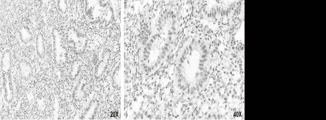 ERCC4 / XPF Antibody - Immunohistochemical staining of paraffin-embedded human uterus using anti-XPF clone UMAB20 mouse monoclonal antibody  1:50 with Polink2 Broad HRP DAB detection kit; heat-induced epitope retrieval with TEE pH9.0 HIER buffer using pressure chamber for 3 minutes at 110C. Nuclear staining is seen in the epithiel cells of the uterine gland