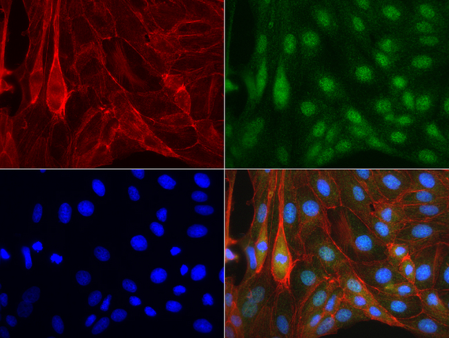 ERCC4 / XPF Antibody - Immunofluorescent staining of MDCK cells using anti-XPF mouse monoclonal antibody  green, 1:50). Actin filaments were labeled with Alexa Fluor® 594 Phalloidin. (red), and nuclear with DAPI. (blue).