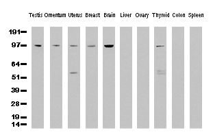 ERCC4 / XPF Antibody - Western Blot analysis of 10 different human tissue lysates. (10ug) by using anti-XPF monoclonal antibody. (clone UMAB20, 1:500)