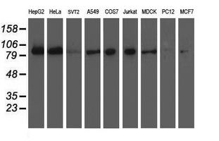 ERCC4 / XPF Antibody - Western blot analysis of crude cell extracts. (35ug) from 9 different cell lines by using anti-XPF. (UMAB21) monoclonal antibody.