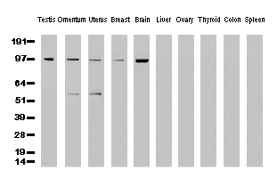 ERCC4 / XPF Antibody - Western Blot analysis of 10 different human tissue lysates. (10ug) by using anti-XPF monoclonal antibody. (clone UMAB21, 1:500)