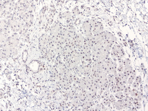 ERCC4 / XPF Antibody - Immunohistochemical staining of paraffin-embedded human pancreas using anti-XPF clone UMAB20 mouse monoclonal antibody  1:50 with Polink2 Broad HRP DAB detection kit; heat-induced epitope retrieval with TEE pH9.0 HIER buffer using pressure chamber for 3 minutes at 110C. Nuclear staining is seen in the pancreatic cells.