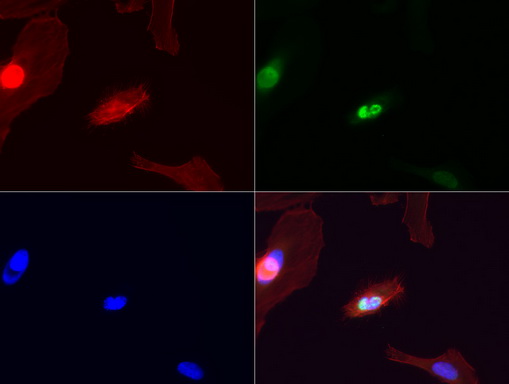 ERCC4 / XPF Antibody - Immunofluorescent staining of HeLa cells using anti-XPF mouse monoclonal antibody  green, 1:100). Actin filaments were labeled with TRITC-phalloidin. (red), and nuclear with DAPI. (blue).