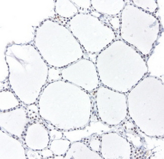 ERCC4 / XPF Antibody - Immunohistochemical staining of paraffin-embedded human thyroid using anti-XPF clone UMAB20 mouse monoclonal antibody  1:50 with Polink2 Broad HRP DAB detection kit; heat-induced epitope retrieval with TEE pH9.0 HIER buffer using pressure chamber for 3 minutes at 110C. Nuclear staining is seen in the thyroid cells.