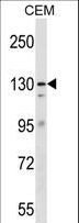 ERCC5 / XPG Antibody - ERCC5 Antibody western blot of CEM cell line lysates (35 ug/lane). The ERCC5 antibody detected the ERCC5 protein (arrow).