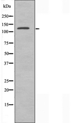 ERCC5 / XPG Antibody - Western blot analysis of extracts of K562 cells using ERCC5 antibody.