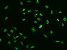 ERCC5 / XPG Antibody - Immunofluorescence staining of ERCC5 in U251MG cells. Cells were fixed with 4% PFA, permeabilzed with 0.1% Triton X-100 in PBS, blocked with 10% serum, and incubated with rabbit anti-Human ERCC5 polyclonal antibody (dilution ratio 1:200) at 4°C overnight. Then cells were stained with the Alexa Fluor 488-conjugated Goat Anti-rabbit IgG secondary antibody (green). Positive staining was localized to Nucleus.