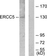 ERCC5 / XPG Antibody - Western blot analysis of extracts from K562 cells, using ERCC5 antibody.