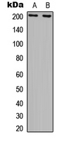 ERCC5 / XPG Antibody - Western blot analysis of ERCC5 expression in COLO205 (A); GM00637 (B) whole cell lysates.
