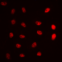 ERCC5 / XPG Antibody - Immunofluorescent analysis of ERCC5 staining in A549 cells. Formalin-fixed cells were permeabilized with 0.1% Triton X-100 in TBS for 5-10 minutes and blocked with 3% BSA-PBS for 30 minutes at room temperature. Cells were probed with the primary antibody in 3% BSA-PBS and incubated overnight at 4 deg C in a humidified chamber. Cells were washed with PBST and incubated with a DyLight 594-conjugated secondary antibody (red) in PBS at room temperature in the dark. DAPI was used to stain the cell nuclei (blue).